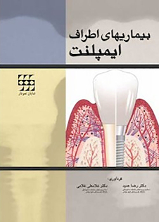 عکس بیماریهای اطراف ایمپلنت