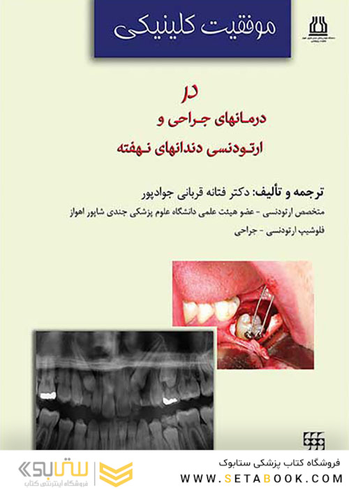 موفقیت کلینیکی در درمان های جراحی و ارتودنسی دندان ها نهفته