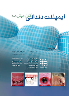 عکس ایمپلنت دندانی میش فصول عمومی