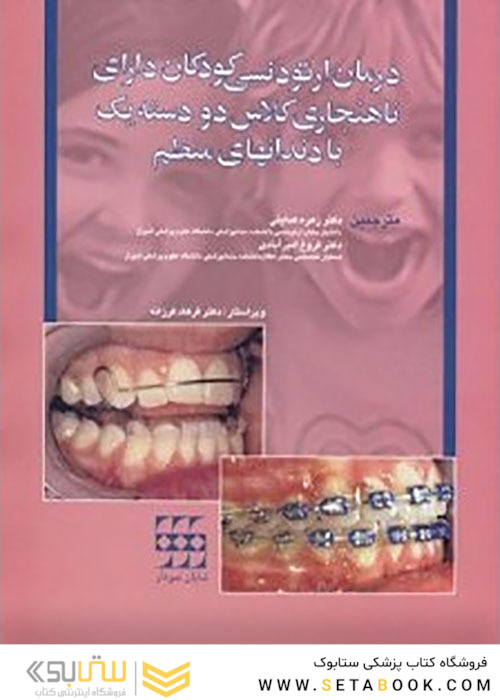 درمان ارتودنسی کودکان دارای ناهنجاری کلاس دو دسته یک با دندانهای منظم