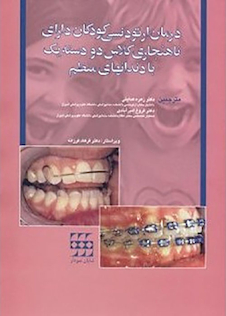 عکس درمان ارتودنسی کودکان دارای ناهنجاری کلاس دو دسته یک با دندانهای منظم