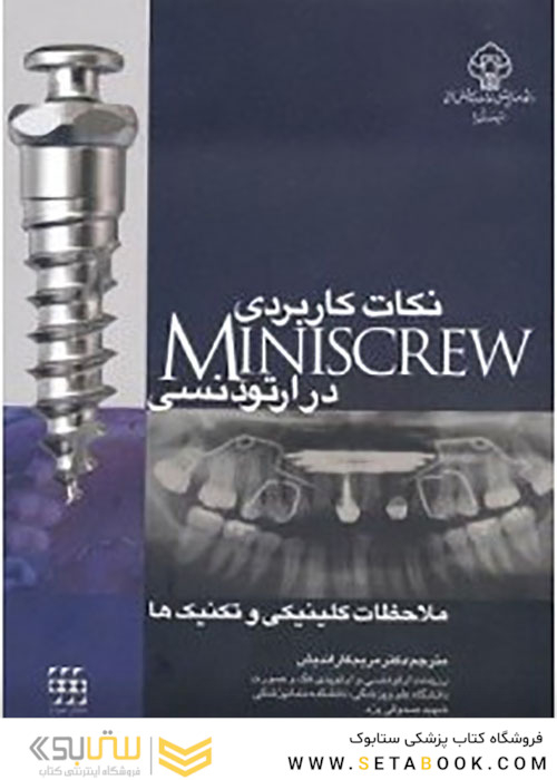 نکات کاربردی Miniscrew در ارتودنسی