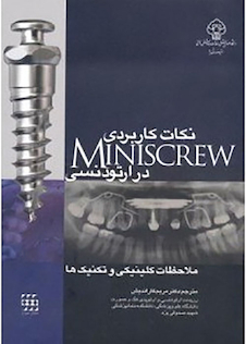 عکس نکات کاربردی Miniscrew در ارتودنسی