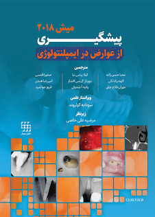 عکس پیشگیری از عوارض در ایمپلنتولوژی میش 2018