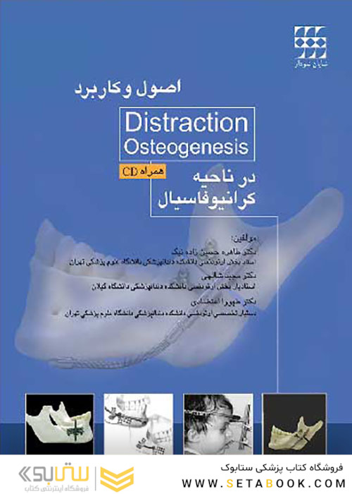 اصول و کاربرد Distraction Osteogenesis در ناحیه کرانیوفاسیال همراه با CD