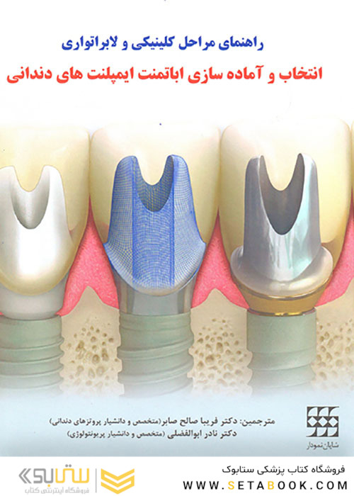 راهنمای مراحل کلینیکی و لابراتواری انتخاب و آماده سازی اباتمنت ایمپلنت های دندانی