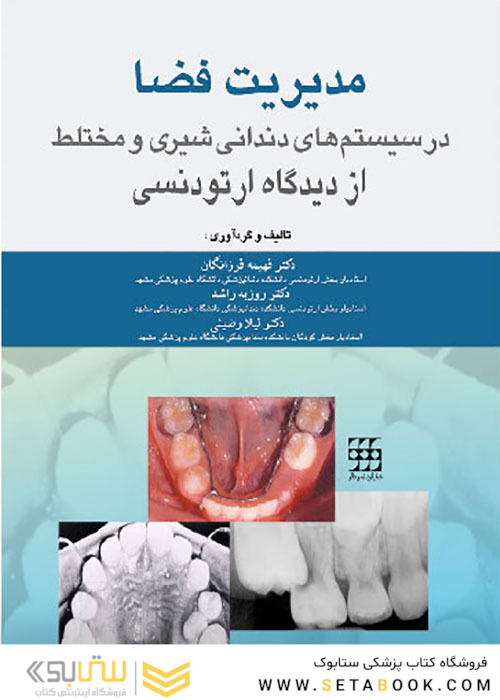 مدیریت فضا در سیستم های دندانی شیری و مختلط از دیدگاه ارتودنسی