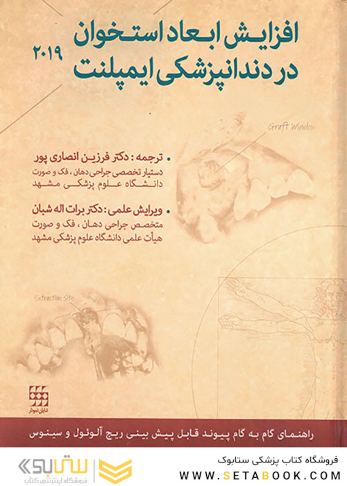 افزایش ابعاد استخوان در دندانپزشکی ایمپلنت 2019