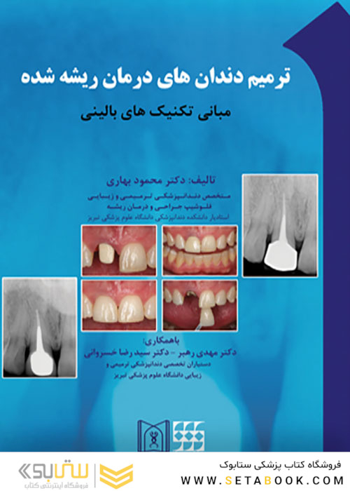 ترمیم دندان های درمان ریشه شده مبانی تکنیک های بالینی