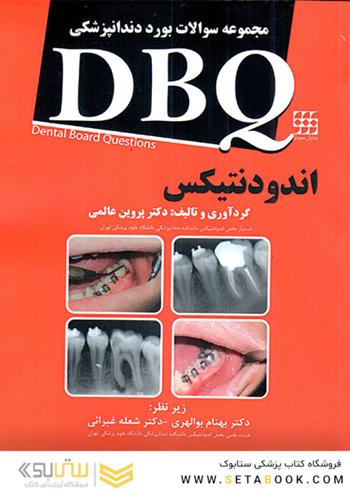 DBQ مجموعه سوالات بورد دندانپزشکی اندودنتیکس