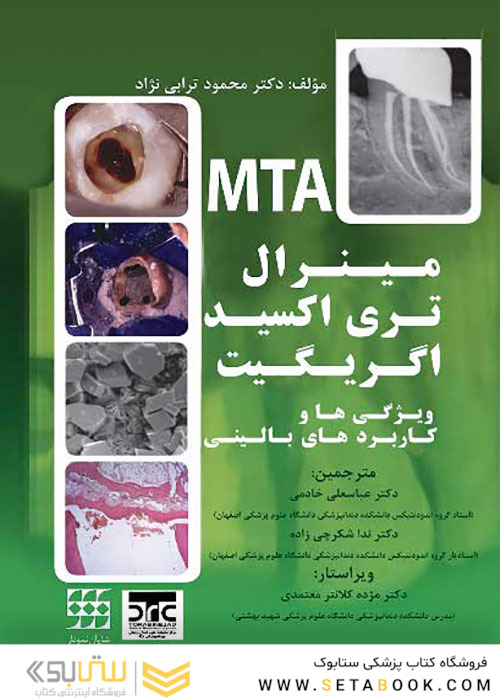 مینرال تری اکسید اگریگیت ویژگی ها و کاربردهای بالینی MTA