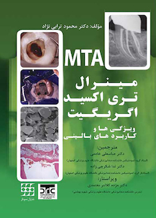 عکس مینرال تری اکسید اگریگیت ویژگی ها و کاربردهای بالینی MTA