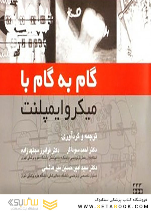 گام به گام با میکروایمپلنت