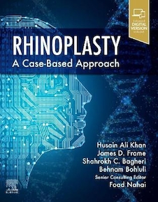 عکس Rhinoplasty : a Case-based approach