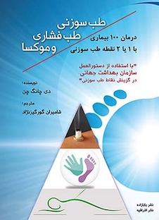 عکس طب سوزنی طب فشاری و موکسا- درمان 100 بیماری با یک یا دو نقطه طب سوزنی