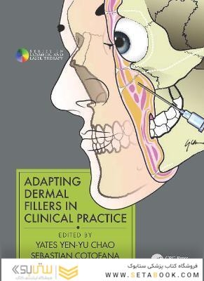 Adapting Dermal Fillers in Clinical Practice
