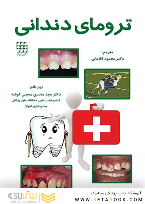 ترومای دندانی
