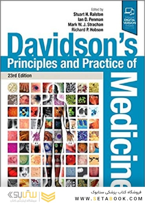 Davidson