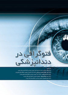 عکس فتوگرافی در دندانپزشکی