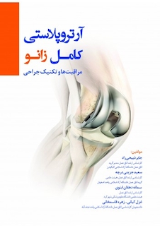 عکس آرتروپلاستی کامل زانو