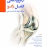 آرتروپلاستی کامل زانو