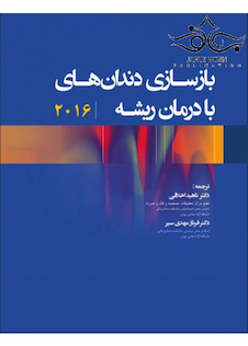 عکس بازسازی دندان های با درمان ریشه 2016