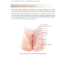 Female Cosmetic Genital Surgery: Concepts, classification and techniques 1st Edition 2017