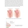 Female Cosmetic Genital Surgery: Concepts, classification and techniques 1st Edition 2017