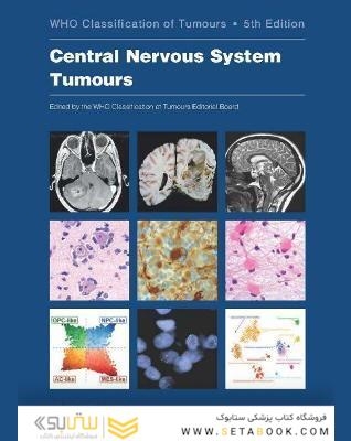 Central Nervous System Tumours (WHO Classification of Tumours) 5th Edición