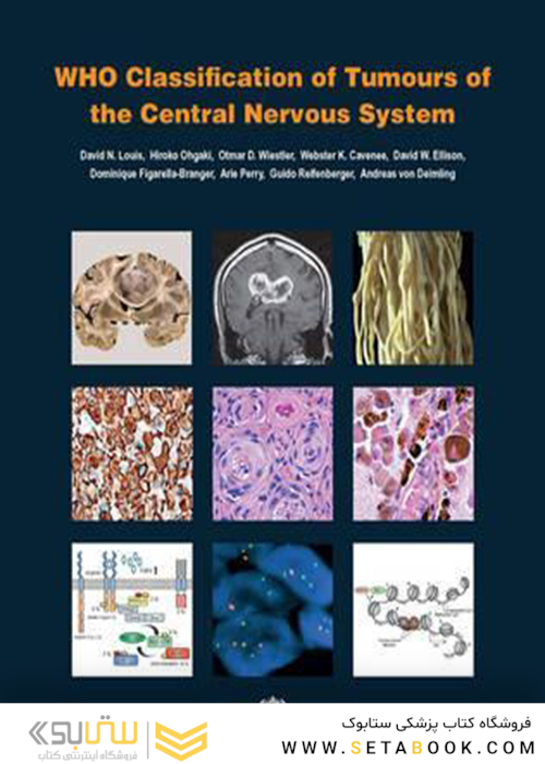 Classification of Tumours of the Central Nervous System, 4th Edition2016 WHO