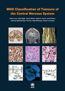 عکس Classification of Tumours of the Central Nervous System, 4th Edition2016 WHO