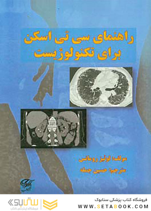 راهنمای سی تی اسکن برای تکنولوژیست