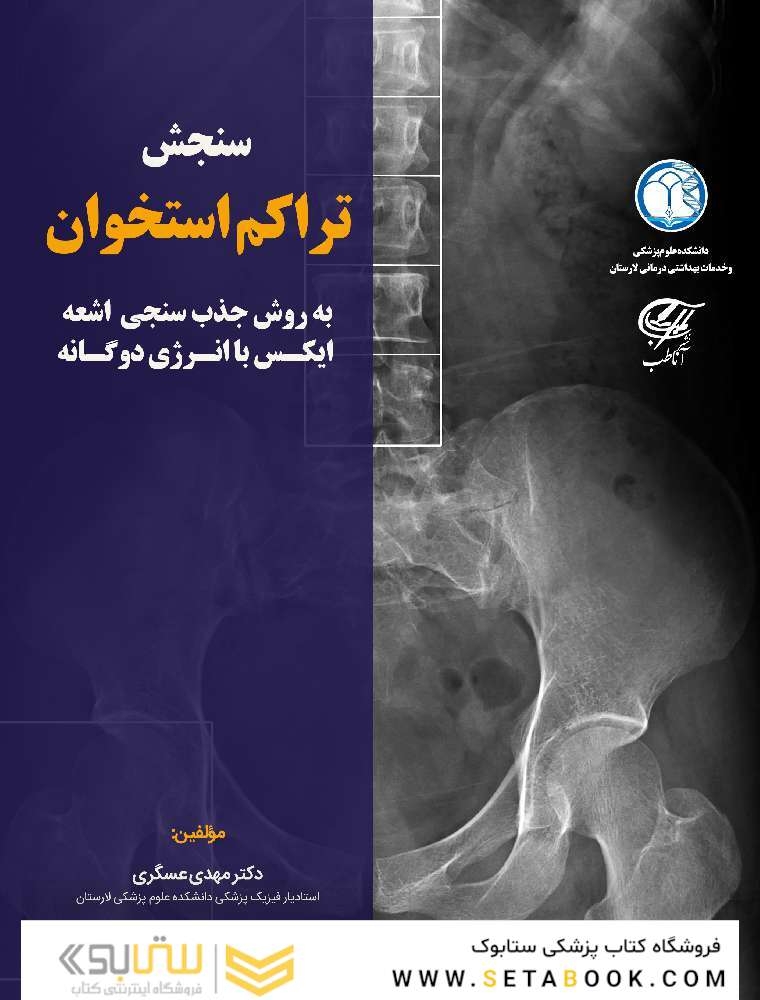 سنجش تراکم استخوان