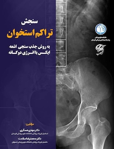 عکس سنجش تراکم استخوان