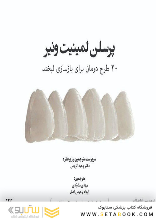 پرسلن لمینیت ونیر
