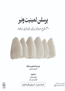 عکس پرسلن لمینیت ونیر