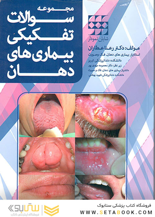 مجموعه سوالات تفکیکی بیماری های دهان