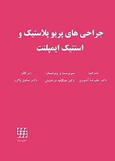 عکس جراحی های پریوپلاستیک و استتیک ایمپلنت