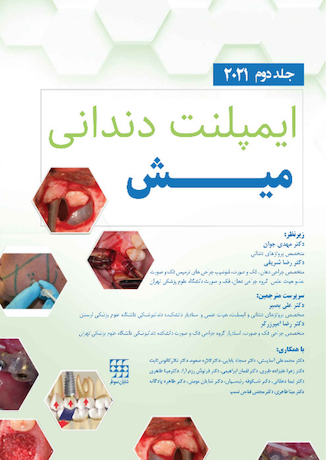 عکس ایمپلنت دندانی میش 2021 جلد دوم