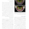 ایمپلنت دندانی میش 2021 جلد دوم