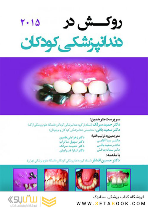 روکش در دندانپزشکی کودکان 2015