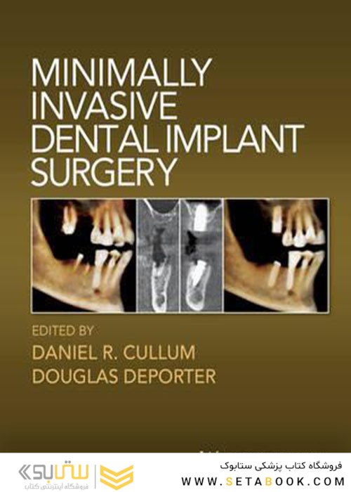 Minimally Invasive Dental Implant Surgery