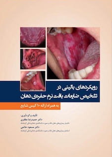عکس رویکردهای بالینی در تشخیص ضایعات بافت نرم حفره ی دهان به همراه ارائه 10 کیس شایع