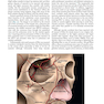 Soft Tissue Augmentation: Procedures in Cosmetic Dermatology Series