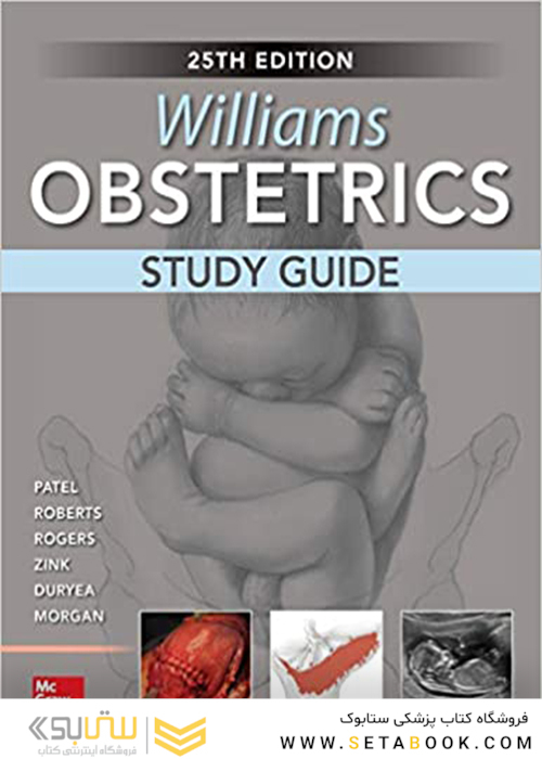 Williams Obstetrics, Study Guide 25th Edition 2019