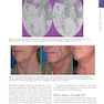 The Art and Science of Facelift Surgery: A Video Atlas 1st Edicion 2019