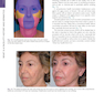 The Art and Science of Facelift Surgery: A Video Atlas 1st Edicion 2019