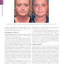 The Art and Science of Facelift Surgery: A Video Atlas 1st Edicion 2019