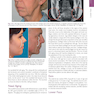 The Art and Science of Facelift Surgery: A Video Atlas 1st Edicion 2019