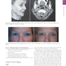 The Art and Science of Facelift Surgery: A Video Atlas 1st Edicion 2019